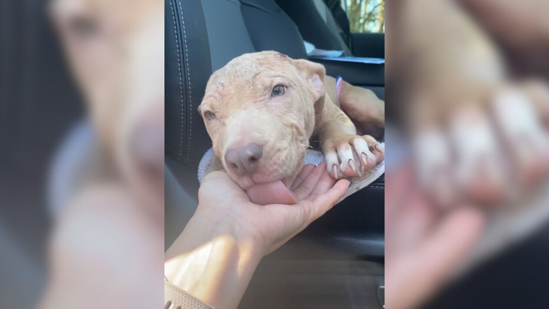 Pittie Suffering From Mange Makes An Amazing Transformation Thanks To Her Amazing Foster Mom